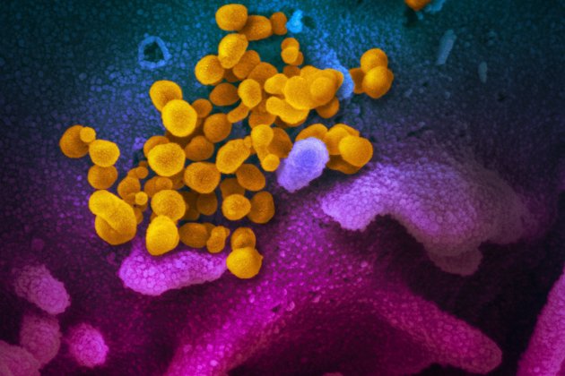 sars cov 2 coronavirus covid ampliacion flickr niaid