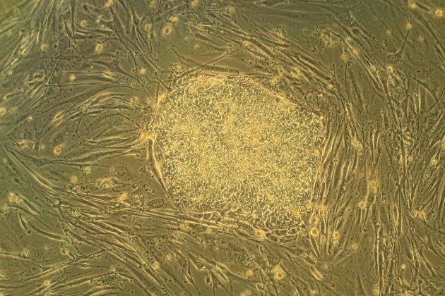 cel·lula embrionària humana cc