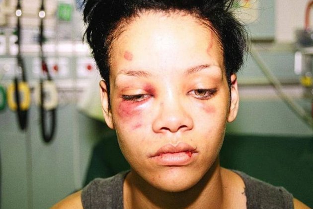 Rihanna golpeada