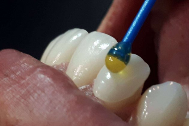 Dientes que se pueden crear con impresoras 3D