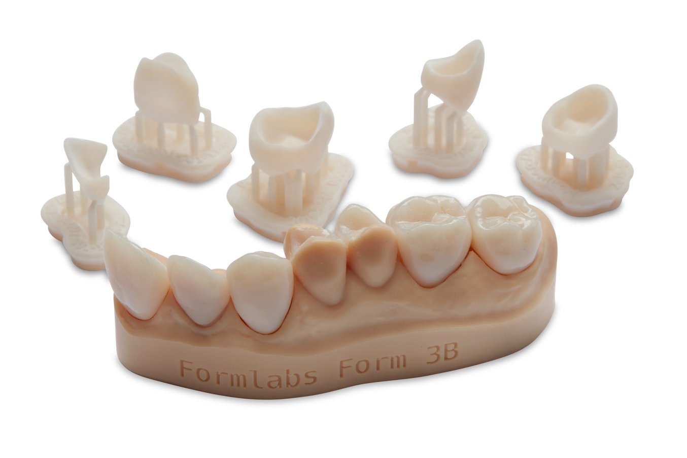 Llegan los implantes dentales 3D que se imprimen en 1 hora