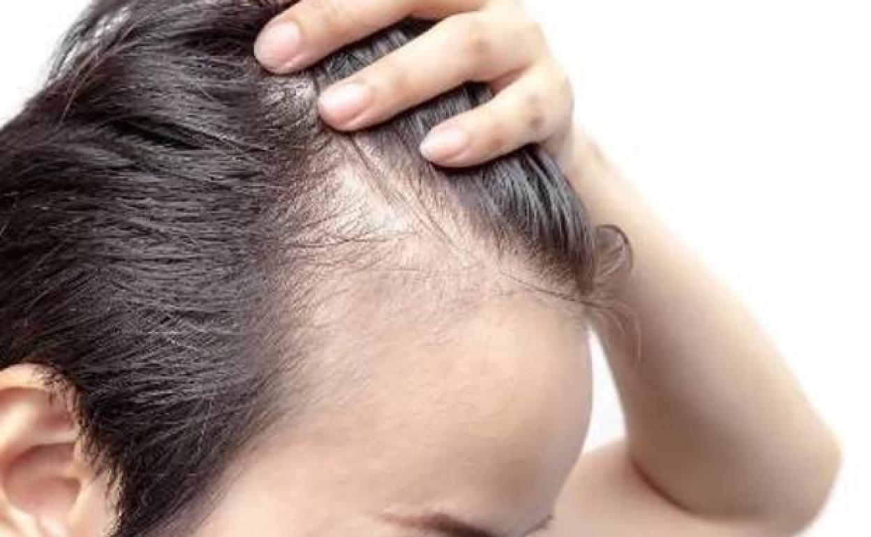 Fin a la calvicie, la biotecnología llega para acabar con la caída de pelo