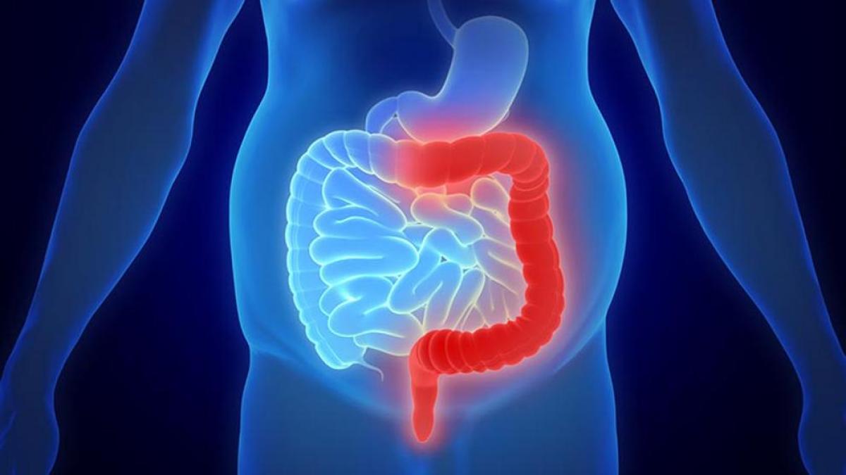Algunos alimentos que nos ayudan a desinflamar el colon