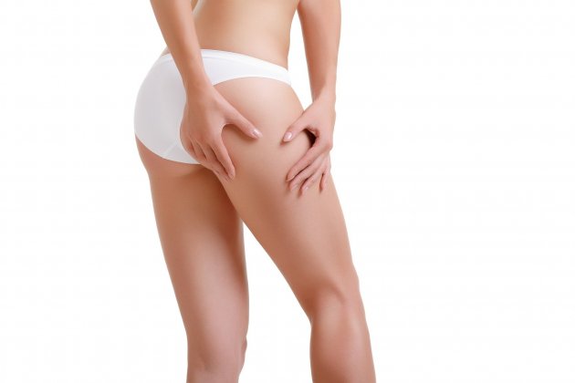 celulitis