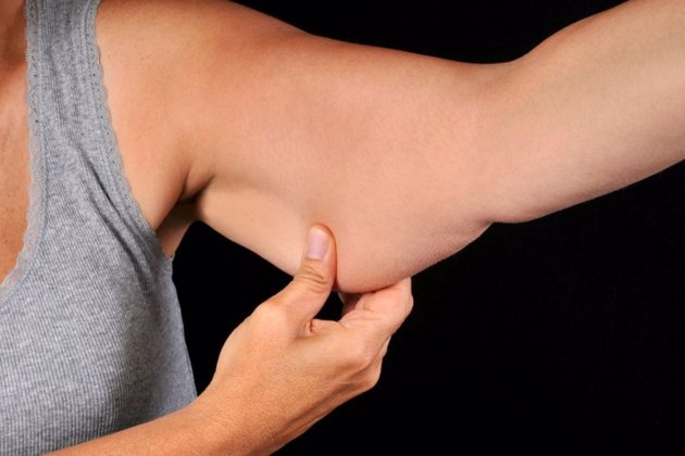 triceps