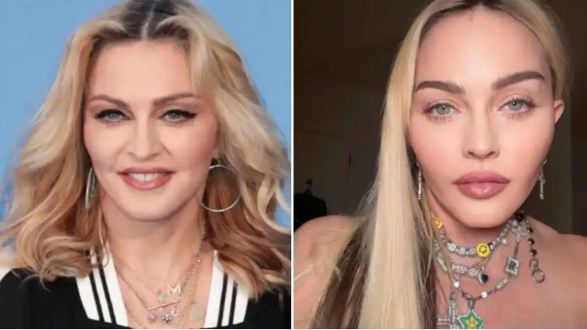 Madonna abans i després