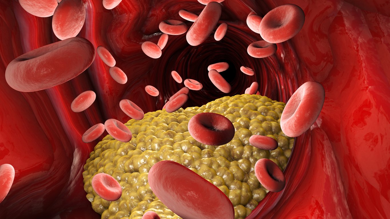 Triglicèrids: aliments a evitar per mantenir els nivells correctes