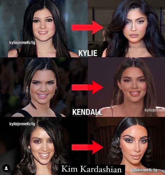 Abans i després de Kylie Jenner, Kendall Jenner i Kim Kardashian