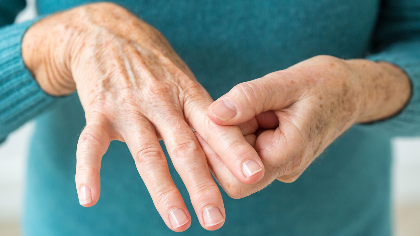 ¿Conoces la artritis reumatoide? Estos son sus aspectos básicos