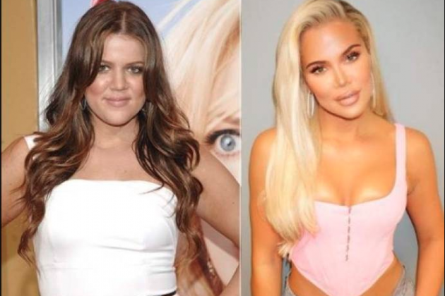 Khloe Kardashian antes y después