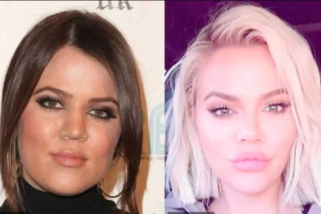 Khloe Kardashian antes y después
