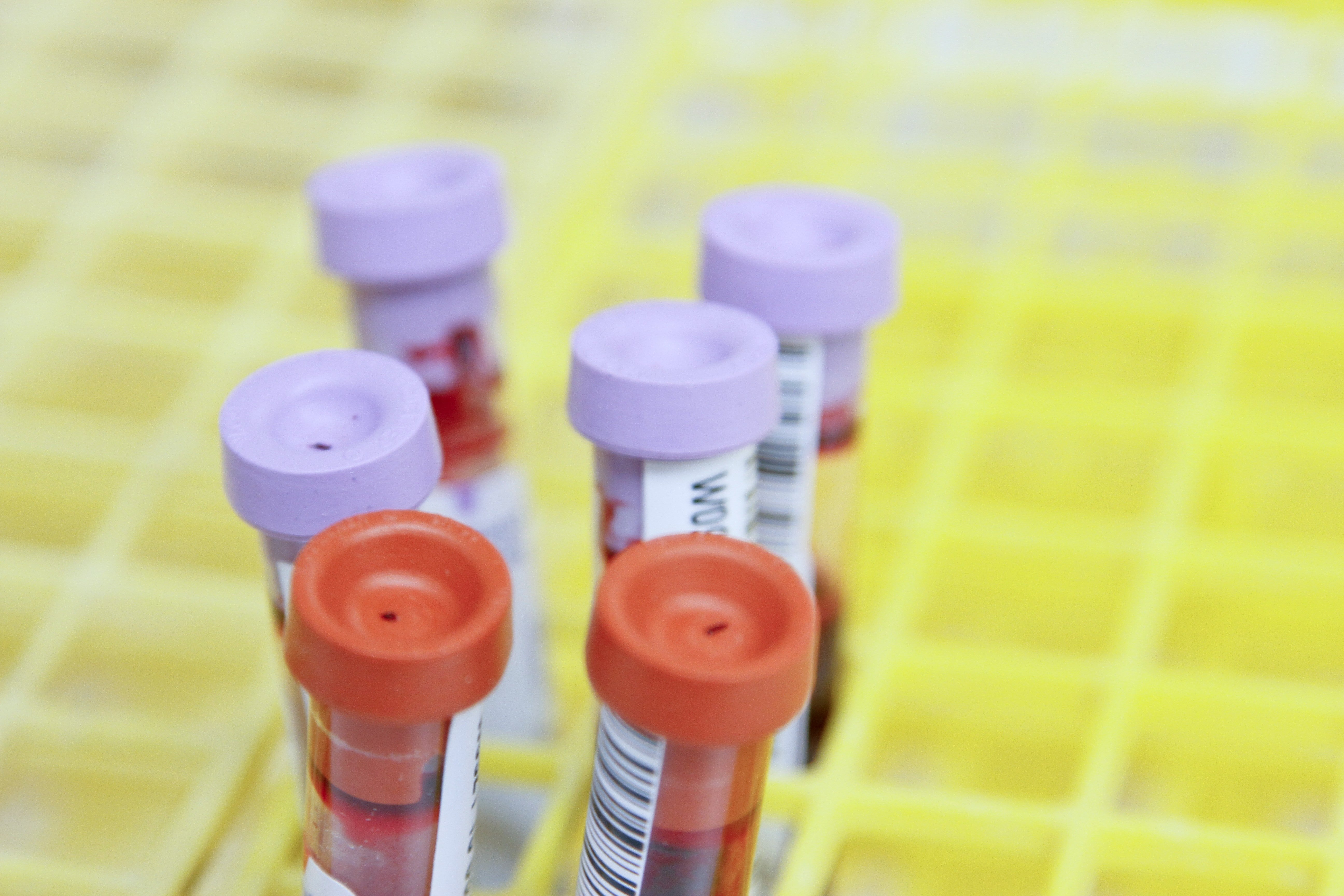 Análisis de sangre Análisis de sangre