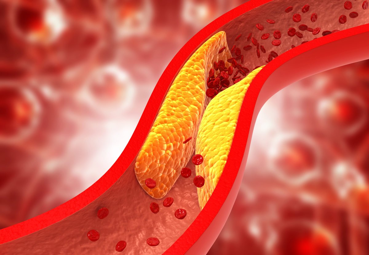 Nivells de colesterol: així és com els pots reduir