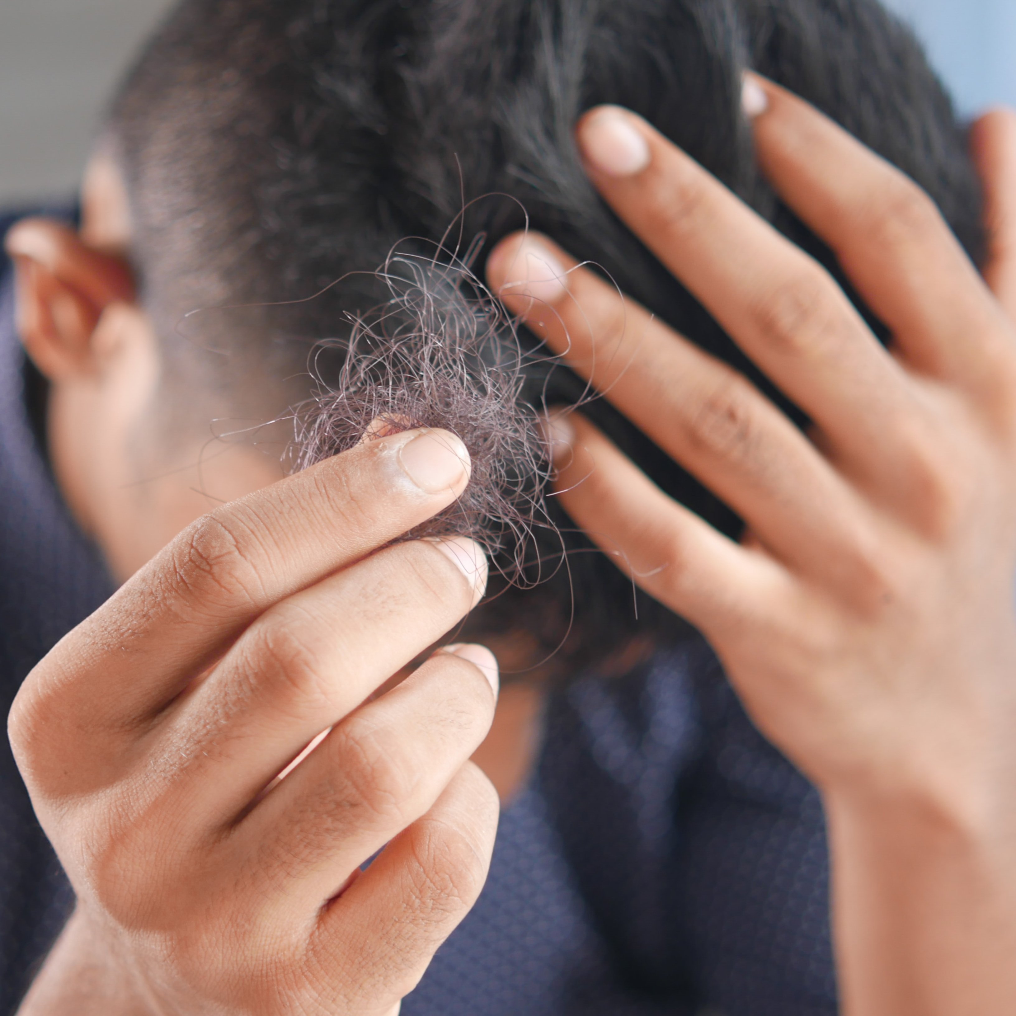 Por qué se cae el cabello en primavera y qué hacer al respecto