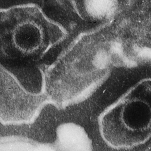 Virus de Epstein Barr   Liza Gross, PLos Biology