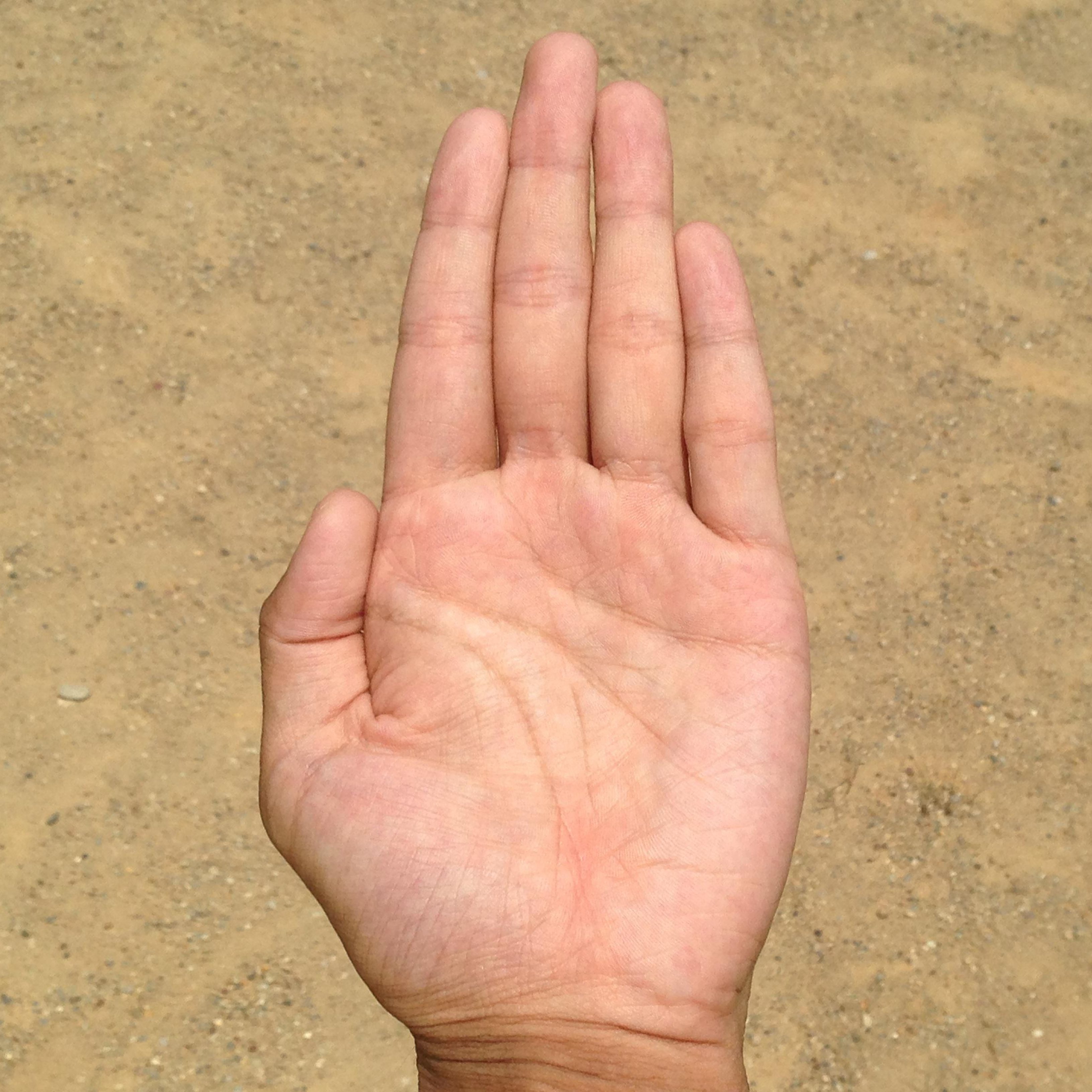 Cómo aliviar la hiperhidrosis de las manos