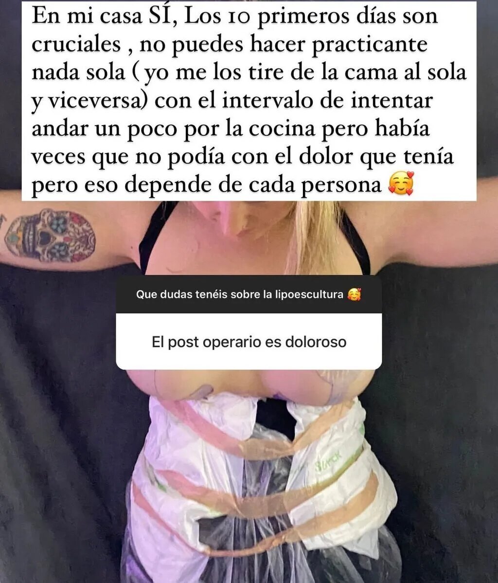 Rocío Flors liposucción xarxes