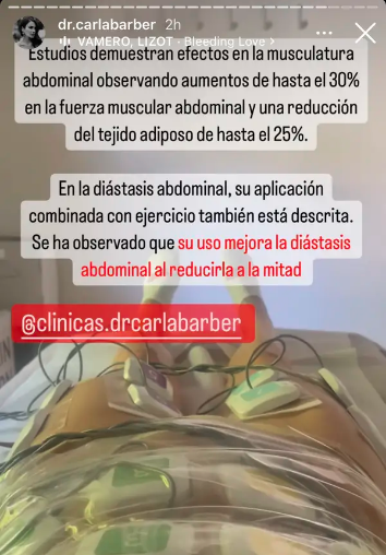 Instastorie de Carla Barber