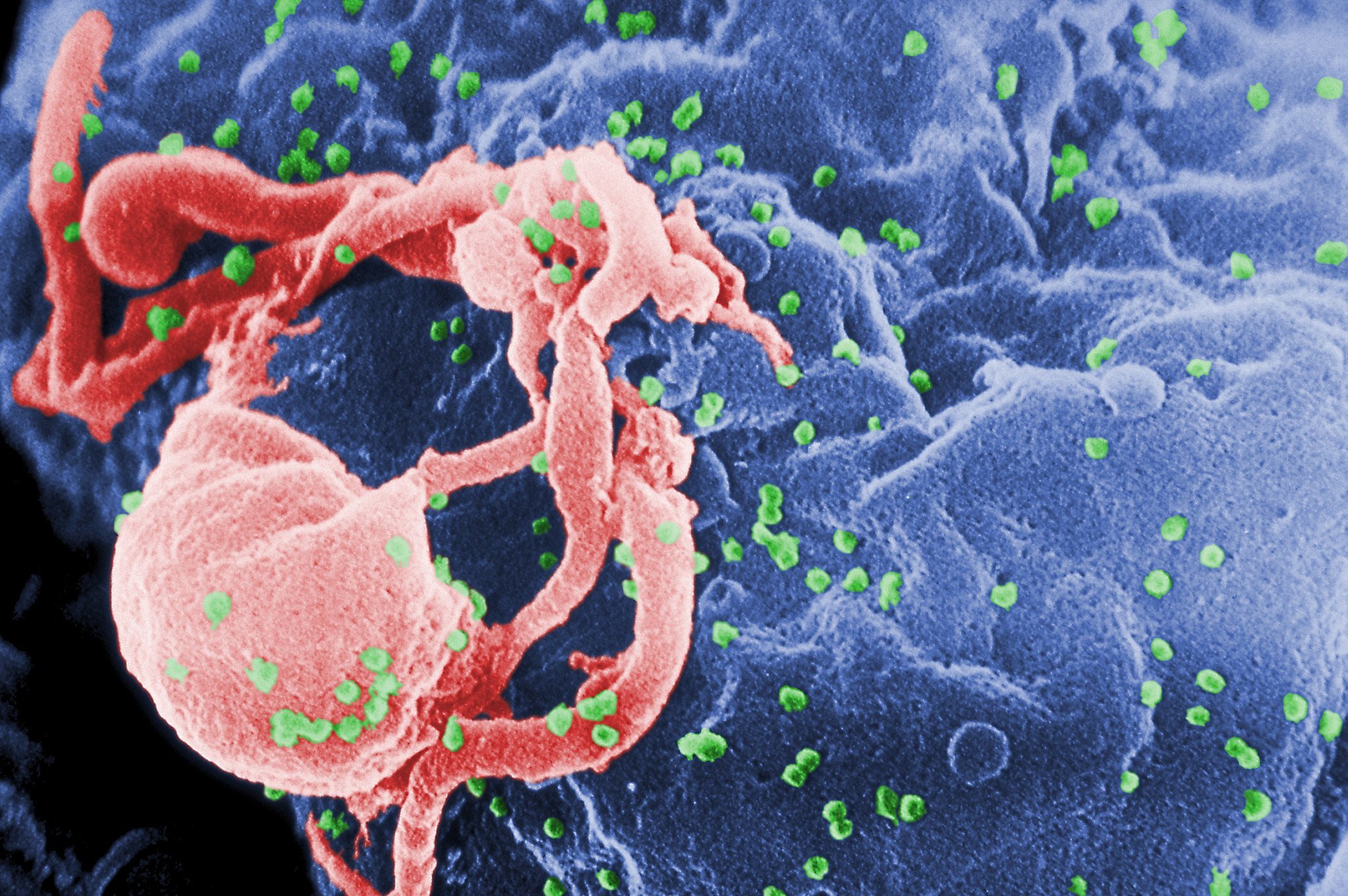 Una combinació d'anticossos contra el VIH, l'alternativa a la teràpia antiretroviral
