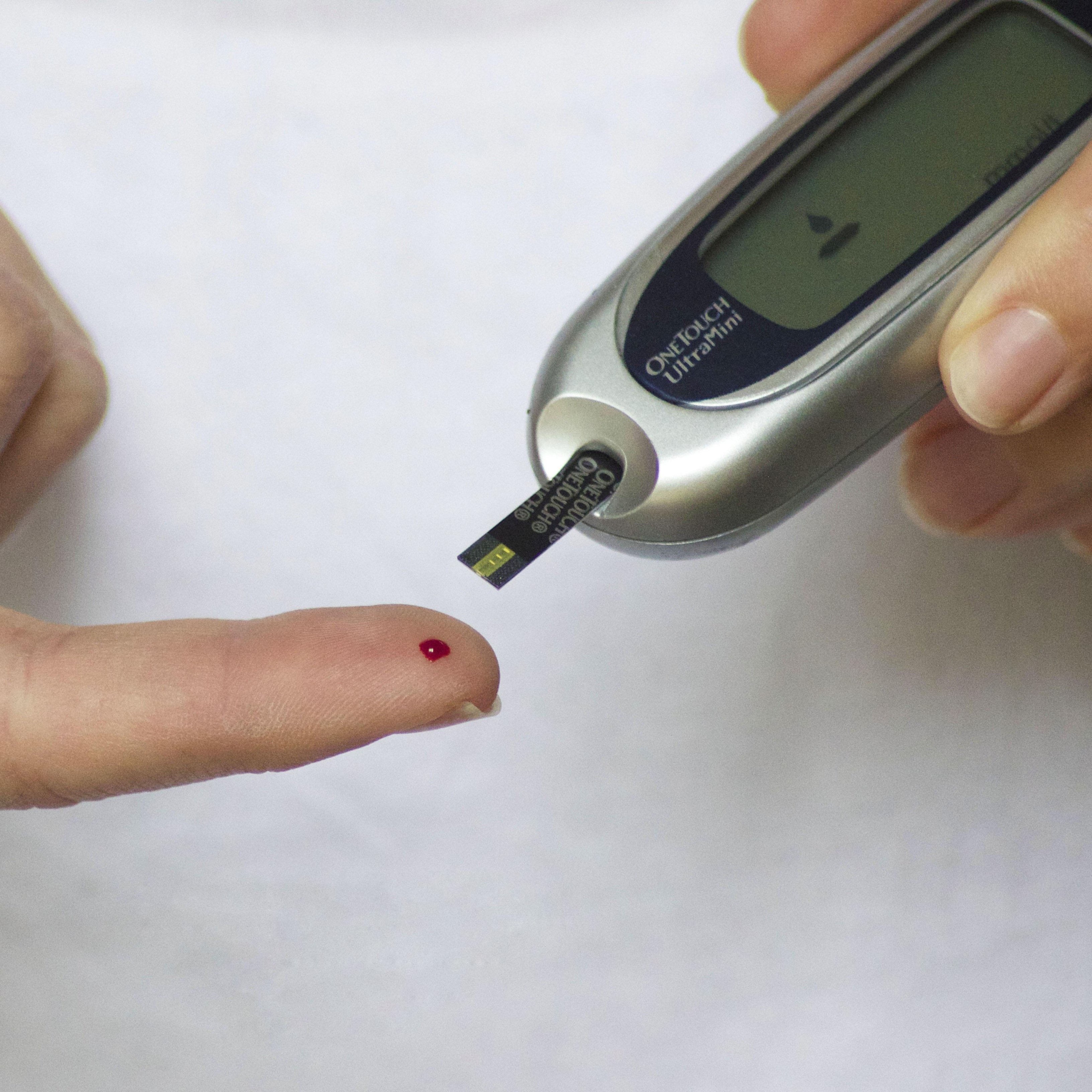 ¿Es genética la diabetes tipo 1?