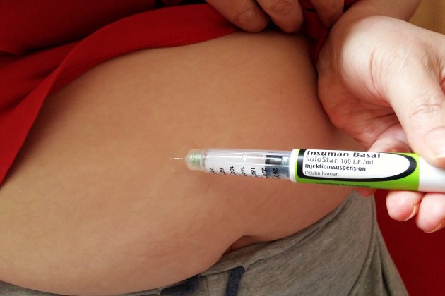 Un hombre se inyecta su dosis de insulina Pixabay