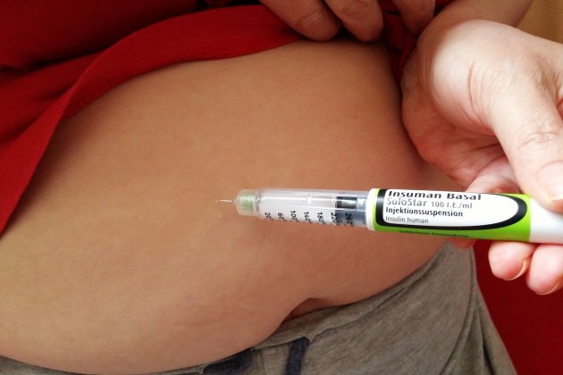 Un hombre se inyecta su dosis de insulina Pixabay Un hombre se inyecta su dosis de insulina Pixabay