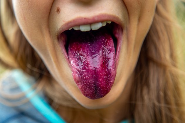 Lengua en tonos morados Lengua en tonos morados