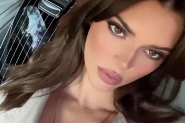 Labios de Kendall Jenner Labios de Kendall Jenner