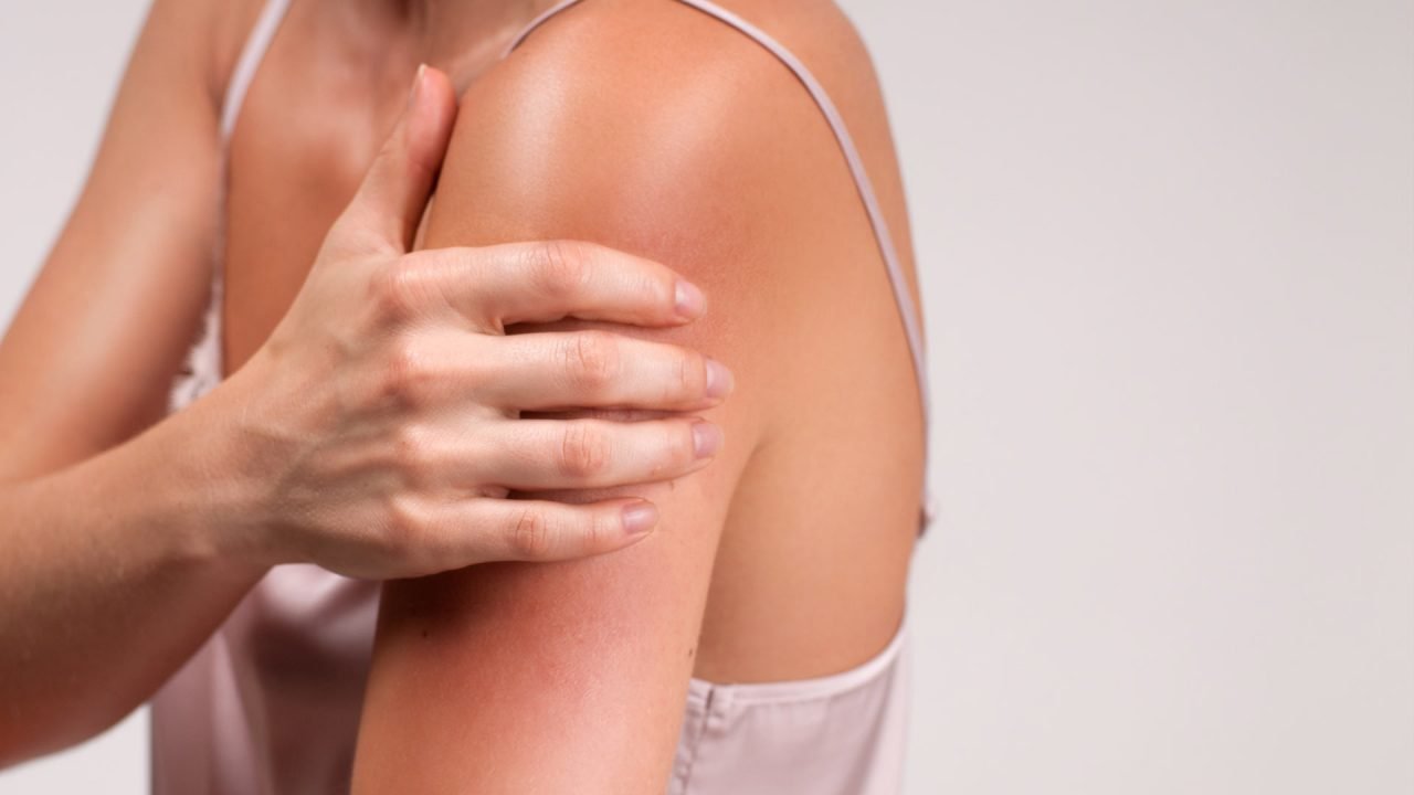 ¿Cómo prevenir la dermatitis atópica este invierno?