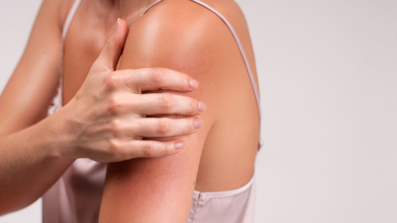 5 motivos que provocan urticaria en nuestro cuerpo