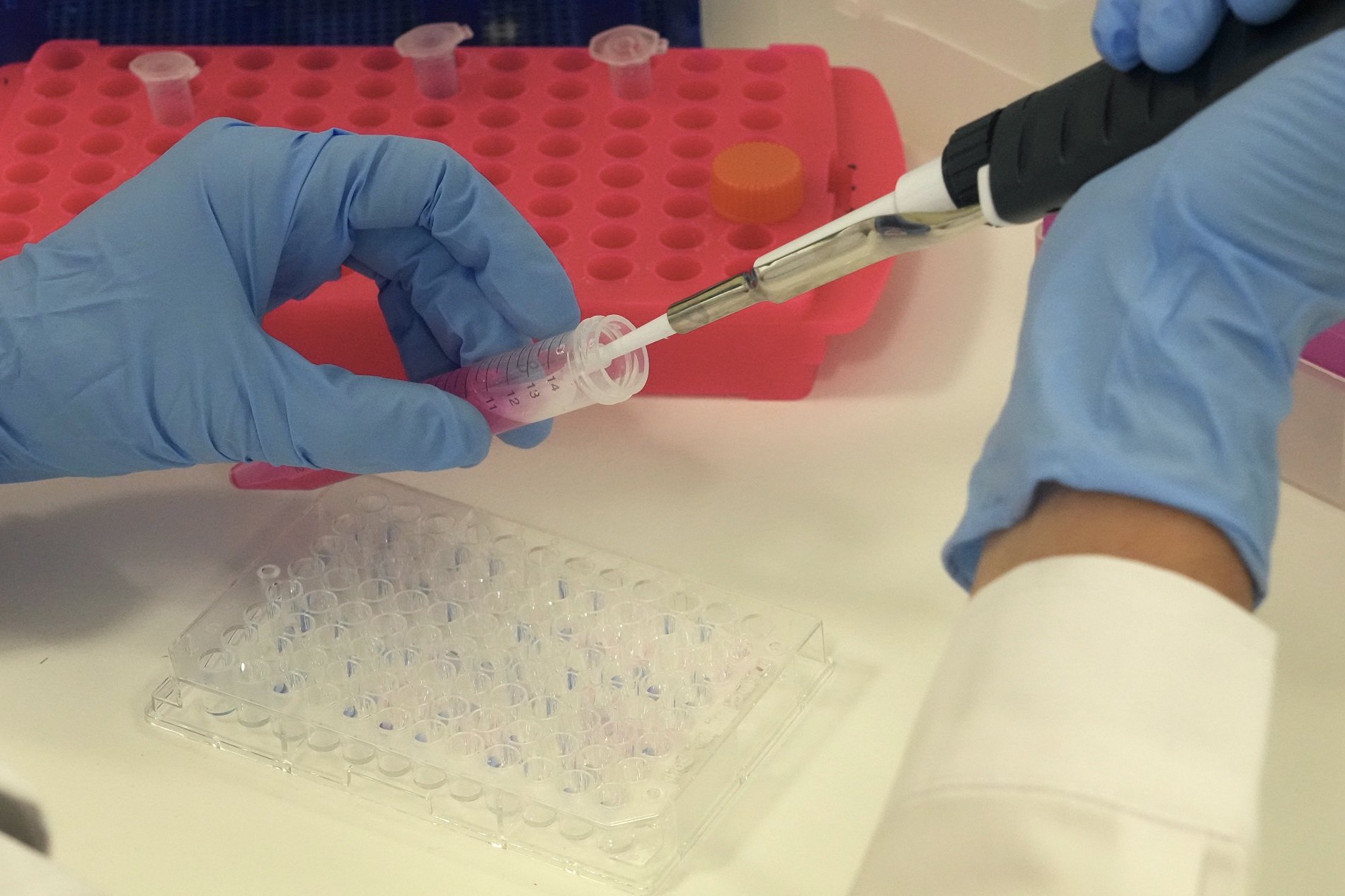 Un virus del constipat pot ajudar a combatre el tumor cerebral infantil més letal