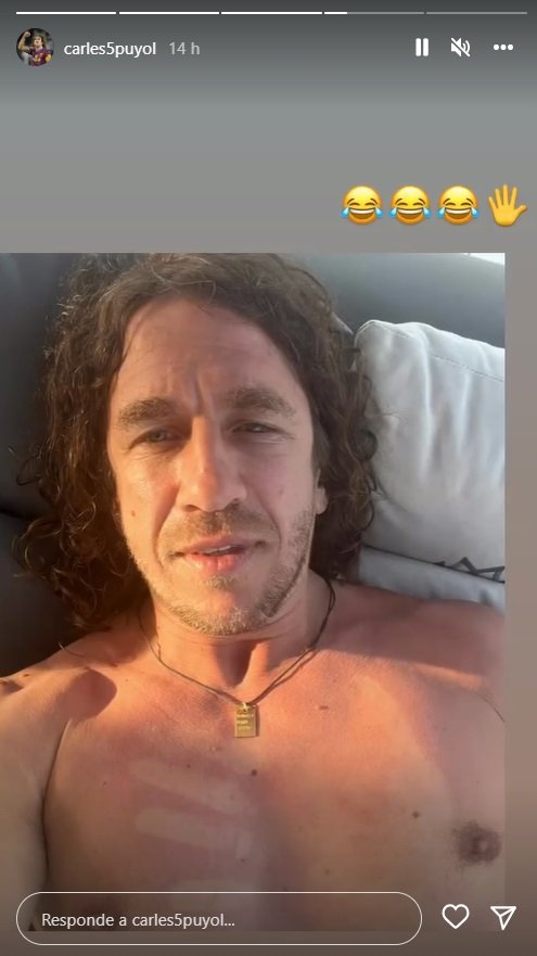 puyol mano pecho sol2 puyol mano pecho sol2
