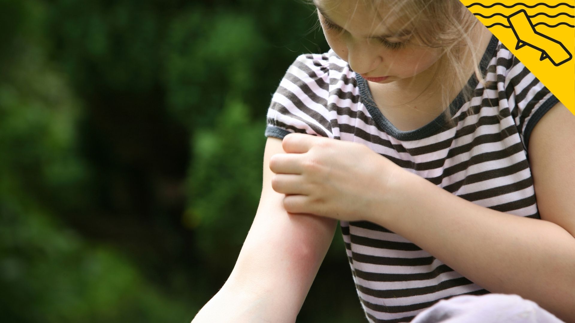 Remeis casolans per calmar picades de mosquit que realment funcionen