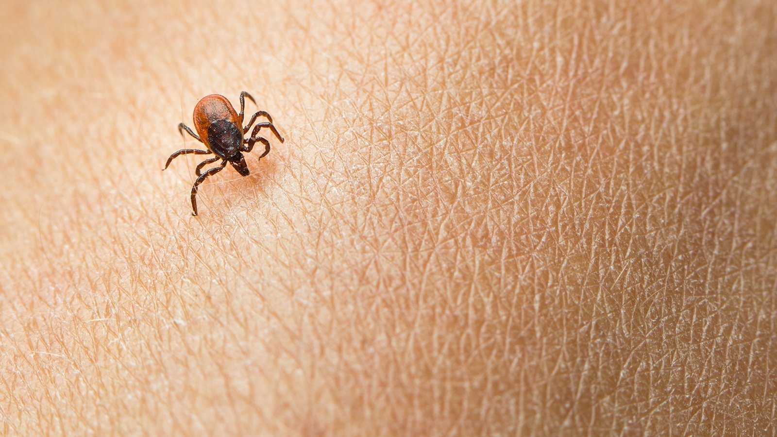 Cómo prevenir las picaduras de garrapata este verano