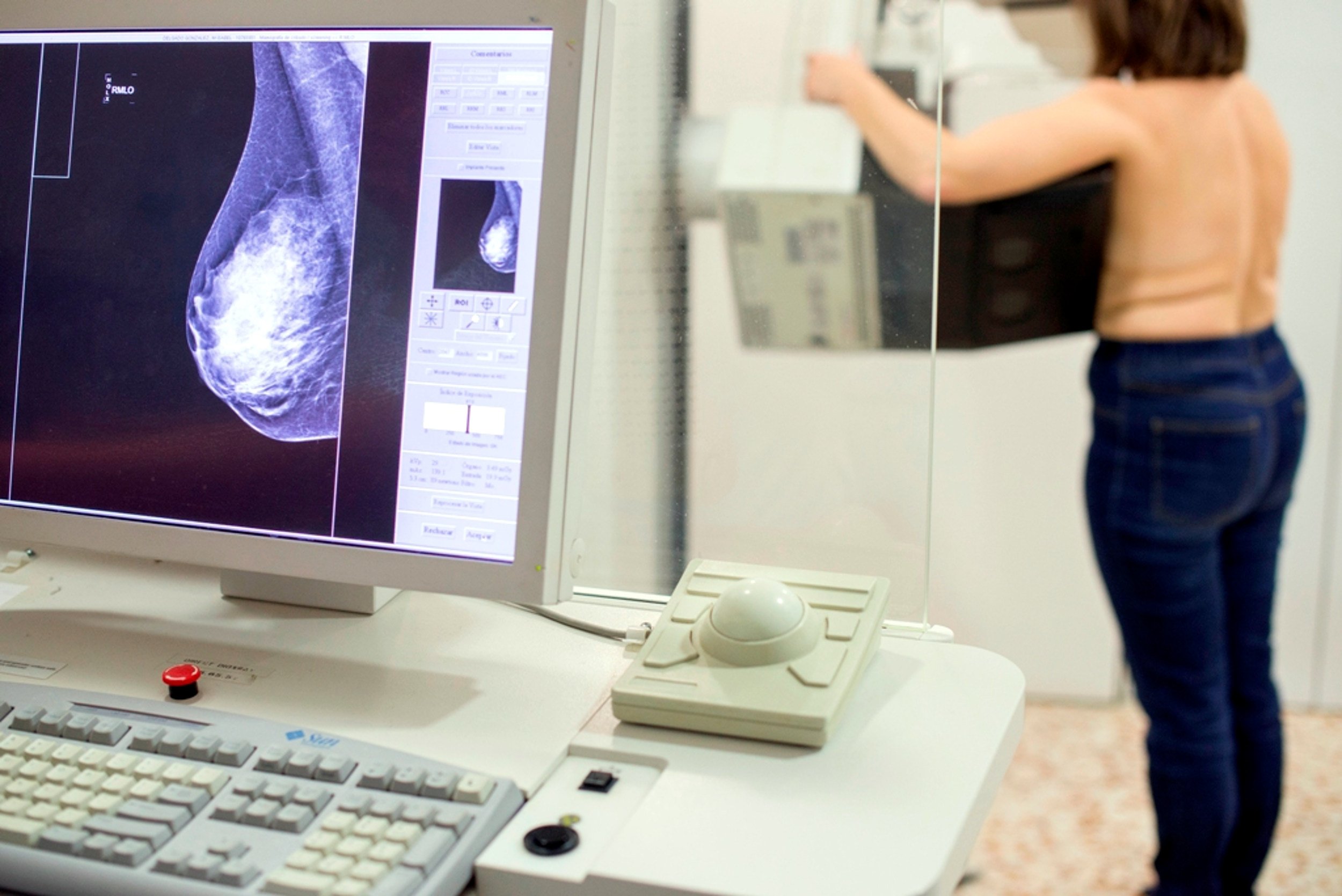 Un nou test de saliva permet detectar el càncer de mama en cinc segons per menys de 5 euros