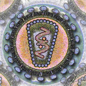 Virus del VIH / Wikimedia Commons
