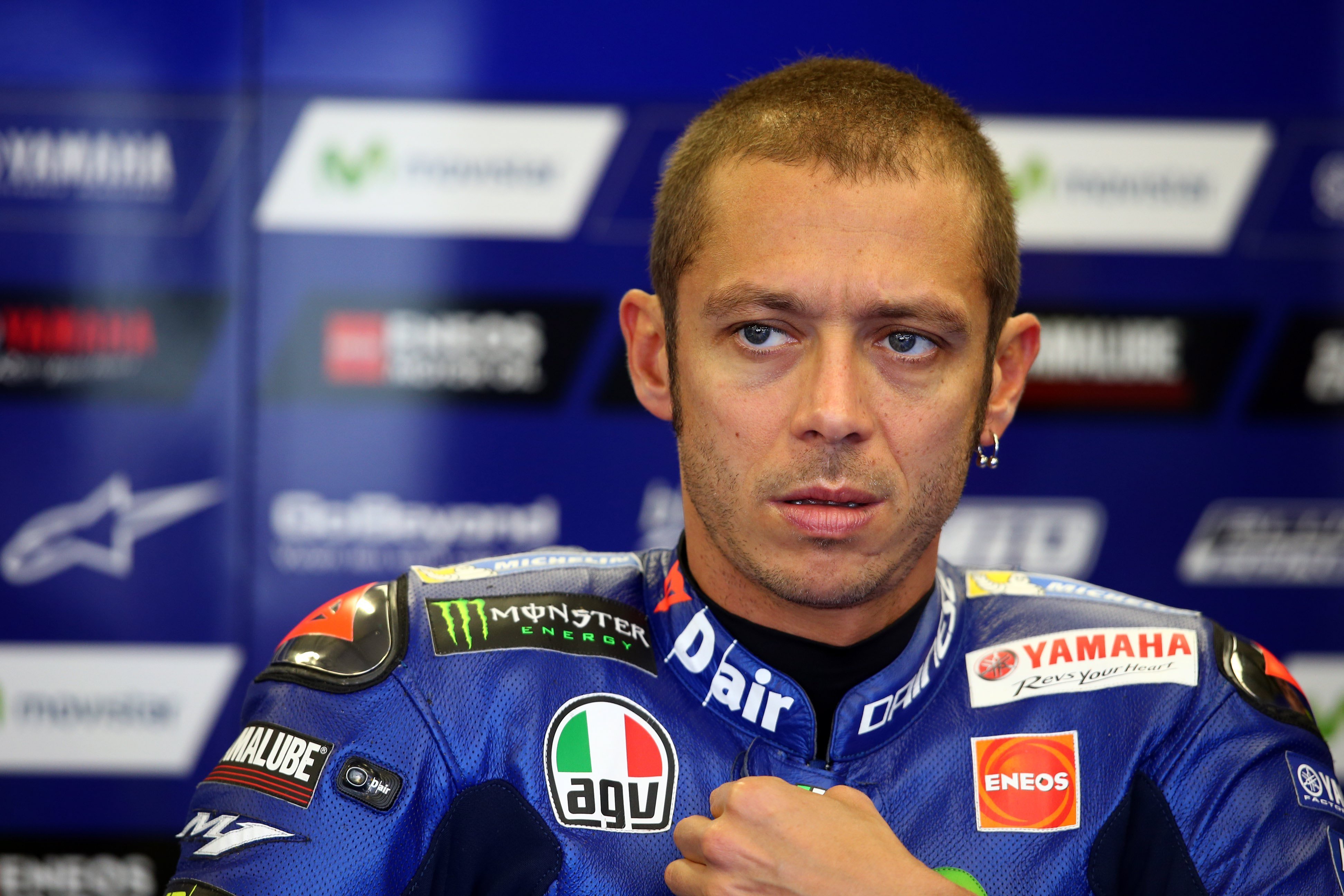Valentino Rossi és operat d'una fractura de tibia i peroné