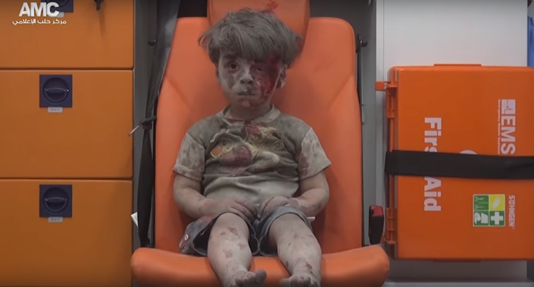 Un nen ferit de 5 anys, imatge de l'horror de la guerra siriana