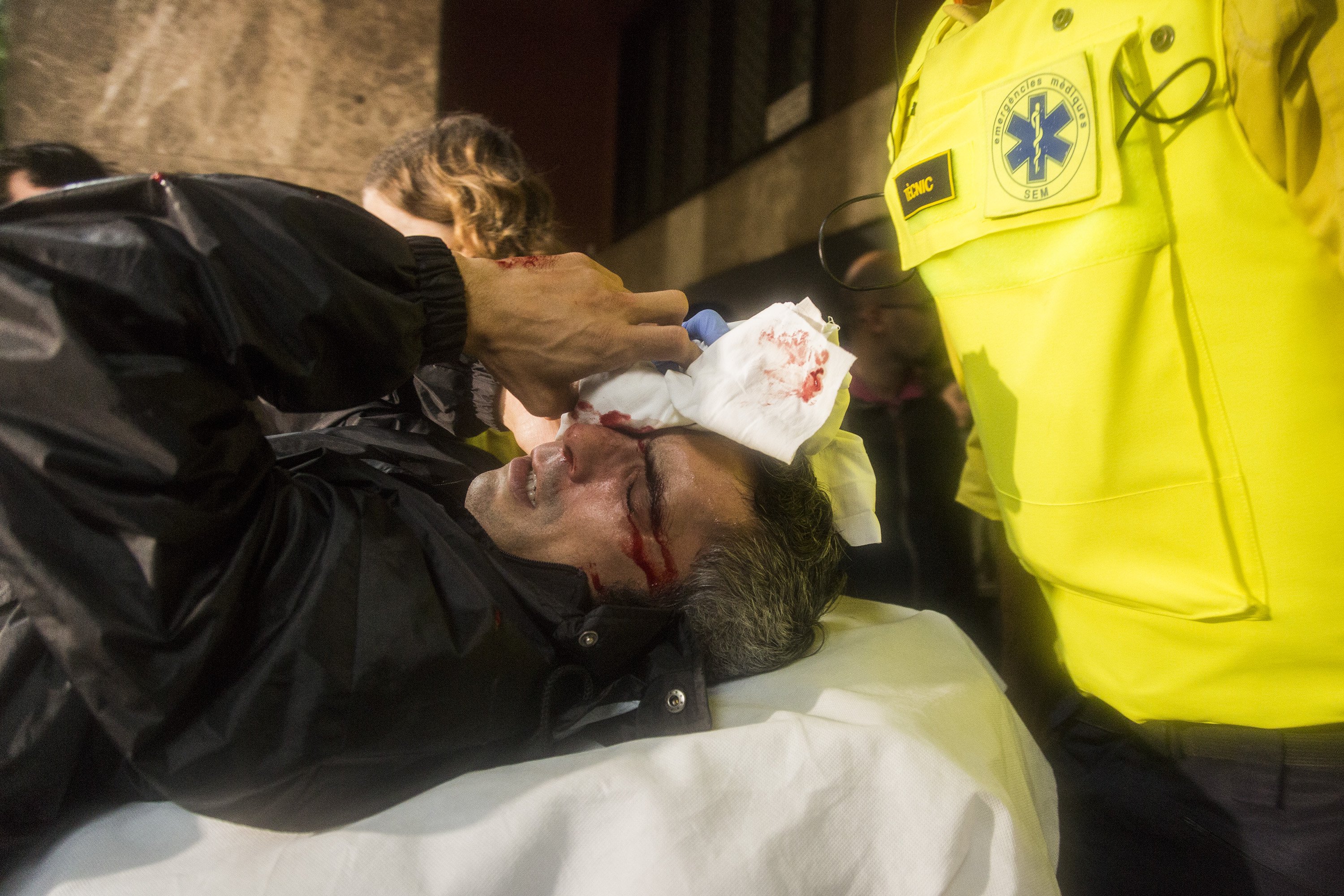 El herido en el ojo por las cargas policiales del 1-O recibe el alta médica