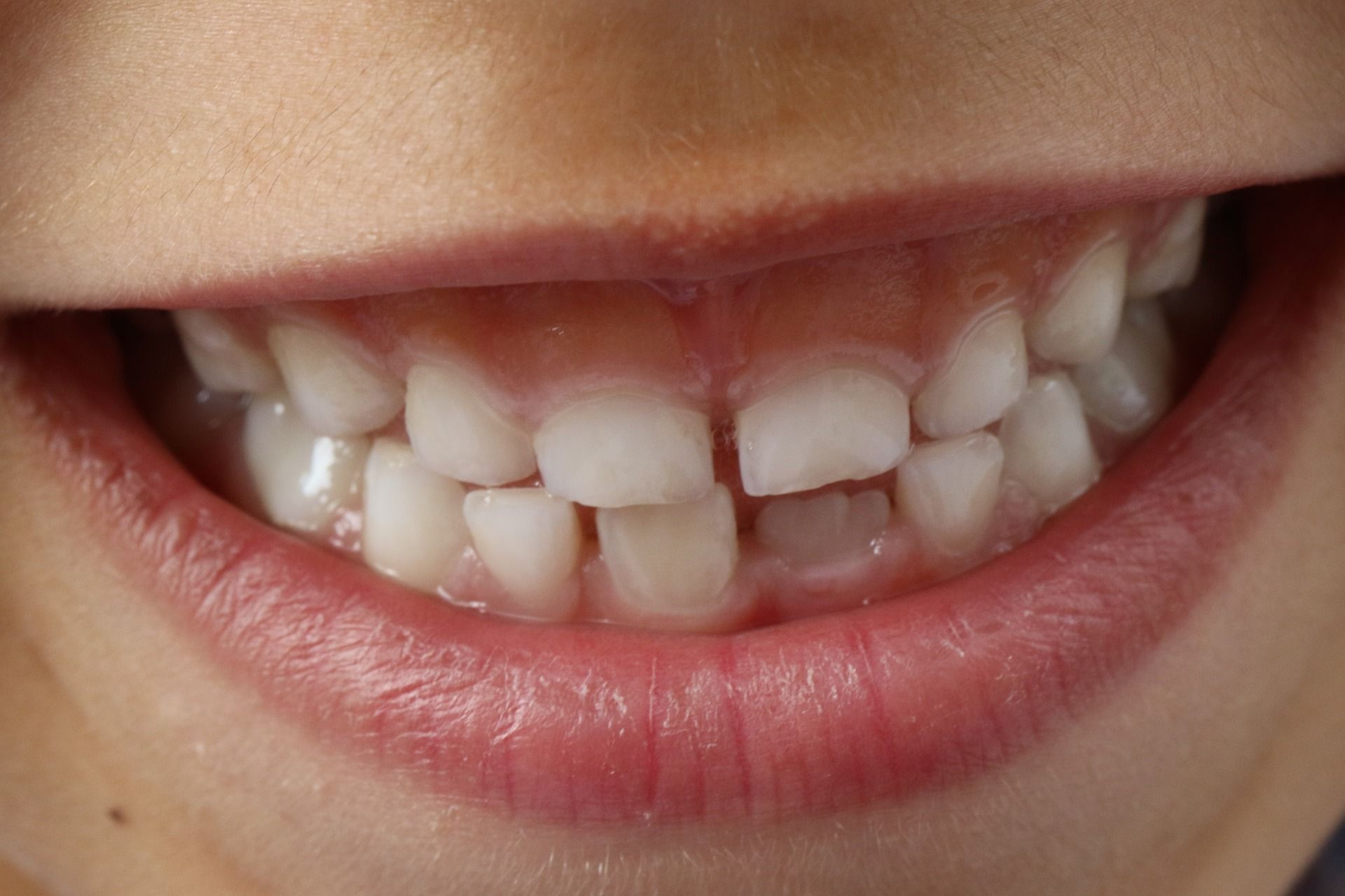 La higiene bucodental es clave para un buen estado de los dientes de los niños