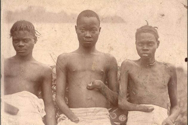 Three boys with hands cut off Presbyterian Historical Society