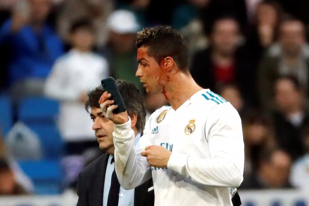 Cristiano Ronaldo ojal Madrid Deportivo EFE