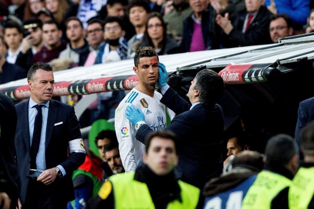 Cristiano Ronaldo sangre Madrid Deportivo EFE