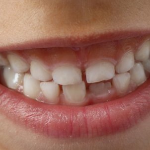 La higiene bucodental es clave para un buen estado de los dientes de los niños