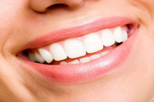 Dientes / Sumuela Dientes / Sumuela