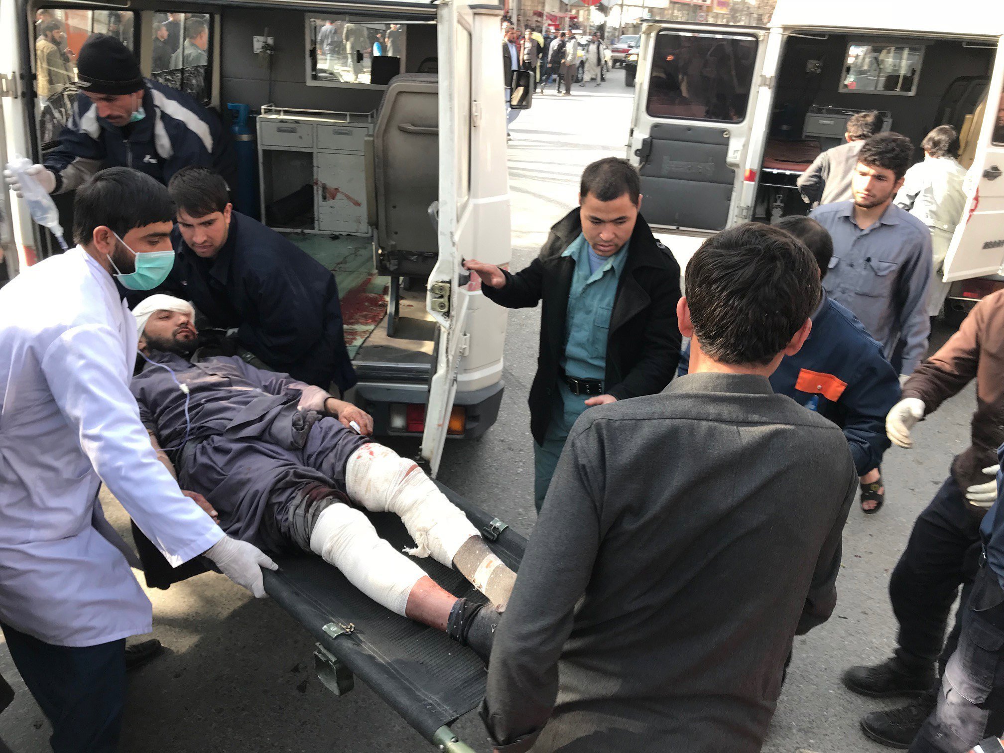 Un mínimo de 95 muertos en un atentado con coche bomba en Kabul
