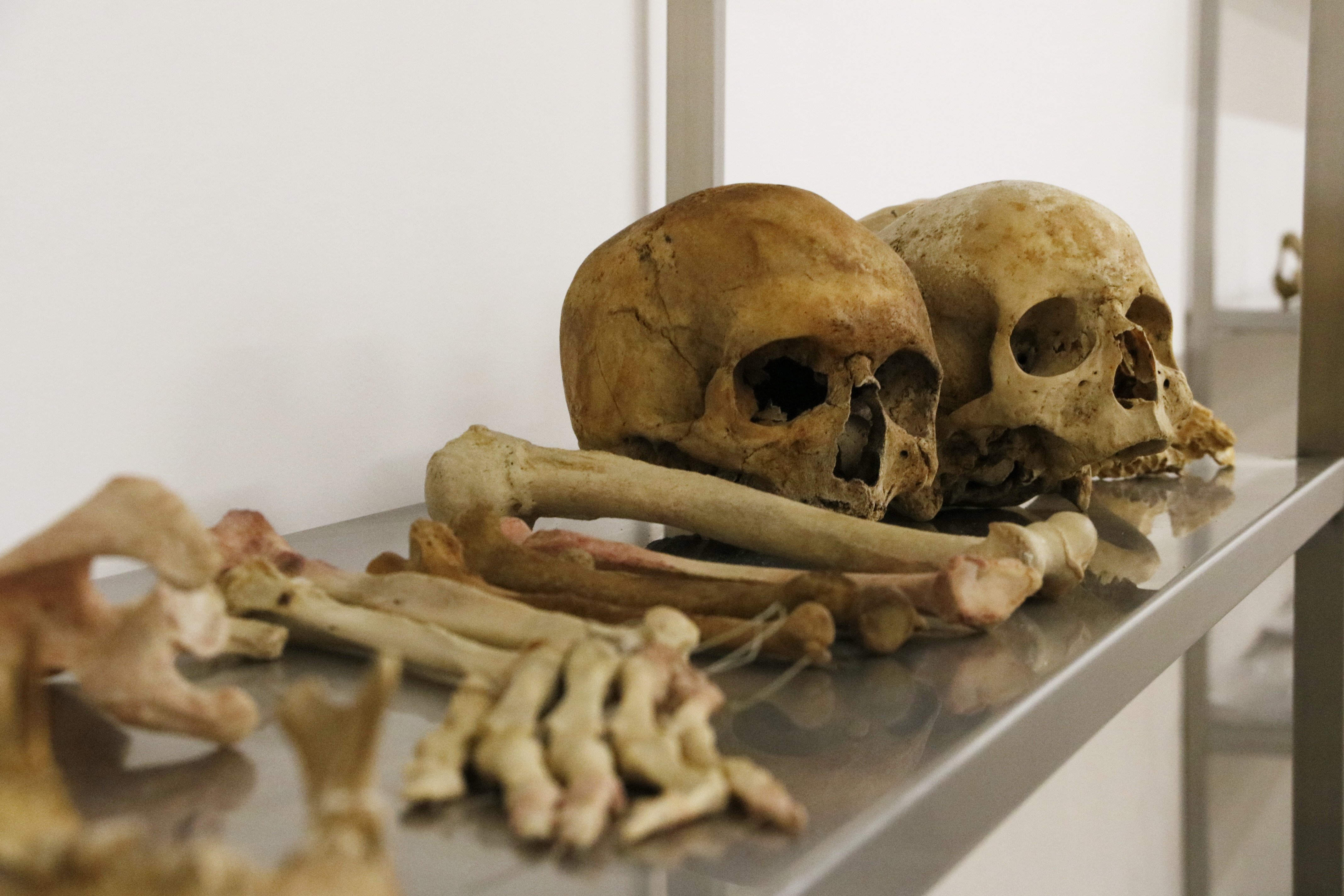 La Facultad de Medicina de Vic permite hacer donaciones de cuerpos para la ciencia