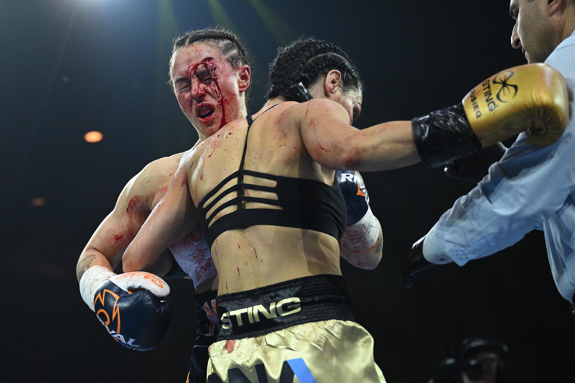 Melbourne (Austràlia)