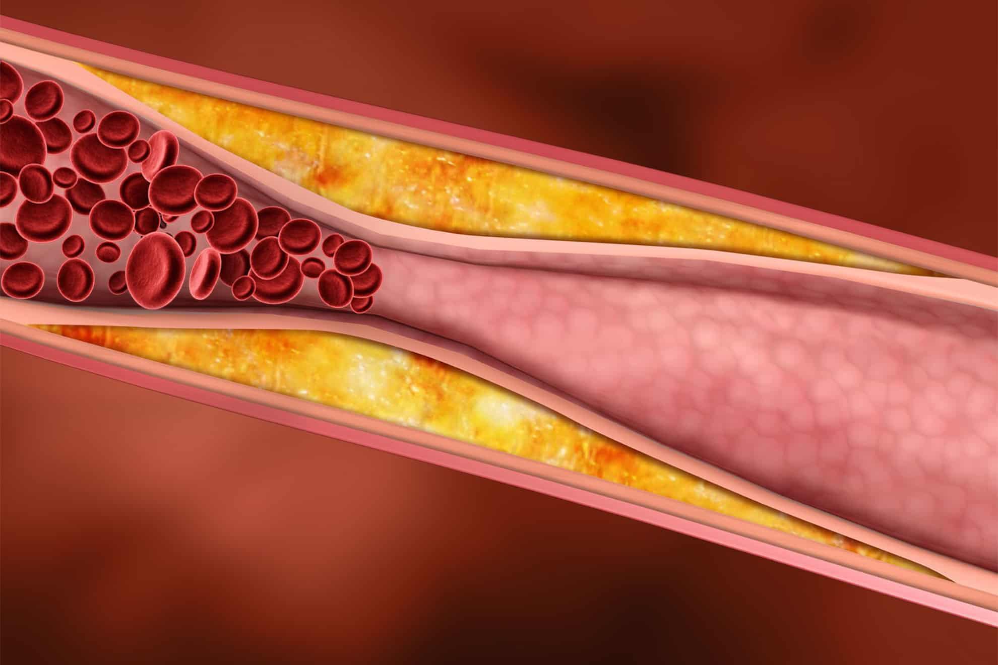 Colesterol i triglicèrids: què són exactament?