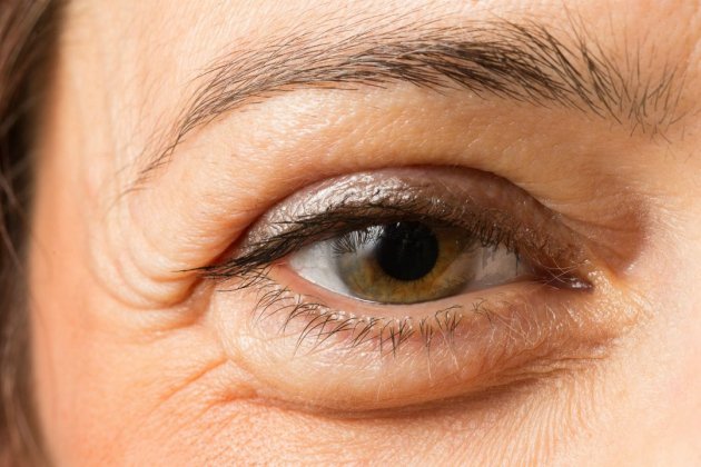 Bolsas Ojos Bolsas Ojos
